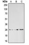BRMS1 Transcriptional Repressor And Anoikis Regulator antibody, orb215108, Biorbyt, Western Blot image 