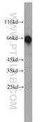 Actin Binding LIM Protein Family Member 2 antibody, 22433-1-AP, Proteintech Group, Western Blot image 