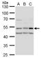 Calcium/Calmodulin Dependent Protein Kinase II Delta antibody, GTX111401, GeneTex, Western Blot image 