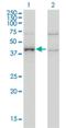 Armadillo Repeat Containing 8 antibody, H00025852-M01, Novus Biologicals, Western Blot image 