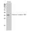 Olfactory Receptor Family 52 Subfamily E Member 2 antibody, STJ94744, St John