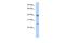 ATPase H+ Transporting V1 Subunit E2 antibody, A13601, Boster Biological Technology, Western Blot image 