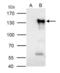 Nuclear Factor Of Activated T Cells 2 antibody, GTX127932, GeneTex, Immunoprecipitation image 