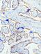 EGFR antibody, A00023, Boster Biological Technology, Immunohistochemistry paraffin image 