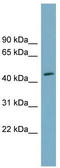 Family With Sequence Similarity 53 Member C antibody, TA345007, Origene, Western Blot image 