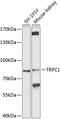 Transient Receptor Potential Cation Channel Subfamily C Member 1 antibody, 23-996, ProSci, Western Blot image 