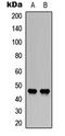 Coagulation Factor III, Tissue Factor antibody, LS-C356029, Lifespan Biosciences, Western Blot image 
