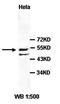 SMAD Family Member 7 antibody, orb77440, Biorbyt, Western Blot image 
