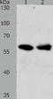 Unc-5 Family C-Terminal Like antibody, TA322008, Origene, Western Blot image 