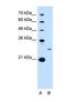 Tetraspanin 15 antibody, NBP1-69340, Novus Biologicals, Western Blot image 