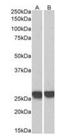 Growth Factor Receptor Bound Protein 2 antibody, orb334087, Biorbyt, Western Blot image 