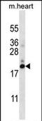 Prefoldin Subunit 5 antibody, PA5-71784, Invitrogen Antibodies, Western Blot image 