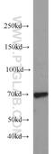 Protein Inhibitor Of Activated STAT 1 antibody, 23395-1-AP, Proteintech Group, Western Blot image 