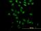 Proline/serine-rich coiled-coil protein 2 antibody, H00196441-B01P, Novus Biologicals, Immunofluorescence image 