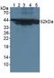 Keratin 18 antibody, LS-C297151, Lifespan Biosciences, Western Blot image 