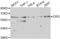 ETS Transcription Factor ERG antibody, abx001152, Abbexa, Western Blot image 