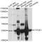 Cytochrome P450 Family 2 Subfamily E Member 1 antibody, MBS127612, MyBioSource, Western Blot image 