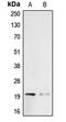 Probetacellulin antibody, MBS820470, MyBioSource, Western Blot image 