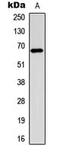 Estrogen Receptor 1 antibody, MBS8212055, MyBioSource, Western Blot image 