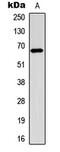 Estrogen Receptor 1 antibody, MBS8212055, MyBioSource, Western Blot image 