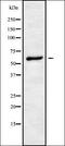 ChaC Glutathione Specific Gamma-Glutamylcyclotransferase 1 antibody, orb338149, Biorbyt, Western Blot image 