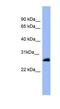 RAB5A, Member RAS Oncogene Family antibody, NBP1-58880, Novus Biologicals, Western Blot image 