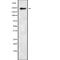 FA Complementation Group M antibody, abx215299, Abbexa, Western Blot image 