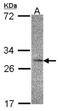 Interleukin 22 Receptor Subunit Alpha 2 antibody, NBP1-32246, Novus Biologicals, Western Blot image 