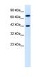 TOX High Mobility Group Box Family Member 2 antibody, orb324356, Biorbyt, Western Blot image 