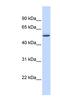 GTP Binding Protein 10 antibody, NBP1-52900, Novus Biologicals, Western Blot image 