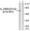 Interleukin 2 Receptor Subunit Beta antibody, PA5-38613, Invitrogen Antibodies, Western Blot image 