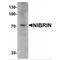 Nibrin antibody, MBS150959, MyBioSource, Western Blot image 