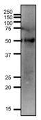 Solute Carrier Family 2 Member 3 antibody, GTX00876, GeneTex, Western Blot image 