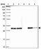 CLC antibody, NBP2-38638, Novus Biologicals, Western Blot image 