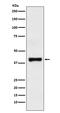 Glutamic-Oxaloacetic Transaminase 2 antibody, M05998-1, Boster Biological Technology, Western Blot image 