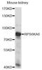 Ribosomal Protein S6 Kinase A6 antibody, LS-C749854, Lifespan Biosciences, Western Blot image 