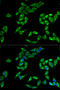 Pleckstrin Homology Like Domain Family A Member 2 antibody, STJ28000, St John