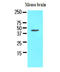 Homer Scaffold Protein 1 antibody, AM09075PU-N, Origene, Western Blot image 