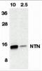 Neurturin antibody, 1121, ProSci Inc, Western Blot image 