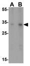 Sirtuin 5 antibody, GTX85104, GeneTex, Western Blot image 