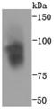 Integrin Subunit Beta 3 antibody, NBP2-67416, Novus Biologicals, Western Blot image 