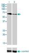 T-Box 5 antibody, H00006910-M01, Novus Biologicals, Western Blot image 