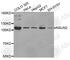 NOP2/Sun RNA Methyltransferase 2 antibody, A3443, ABclonal Technology, Western Blot image 