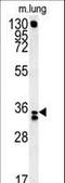 Reticulocalbin 3 antibody, LS-C162519, Lifespan Biosciences, Western Blot image 