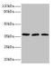 FtsJ RNA 2'-O-Methyltransferase 1 antibody, LS-C285506, Lifespan Biosciences, Western Blot image 