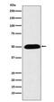 Cytochrome P450 Family 27 Subfamily A Member 1 antibody, M02121-1, Boster Biological Technology, Western Blot image 