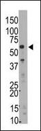 SMYD Family Member 5 antibody, LS-C100481, Lifespan Biosciences, Western Blot image 