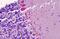Atypical Chemokine Receptor 3 antibody, MBS244775, MyBioSource, Immunohistochemistry paraffin image 