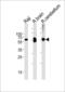 Cystathionine-Beta-Synthase antibody, 62-561, ProSci, Western Blot image 
