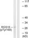 Regulator Of G Protein Signaling 16 antibody, PA5-38913, Invitrogen Antibodies, Western Blot image 